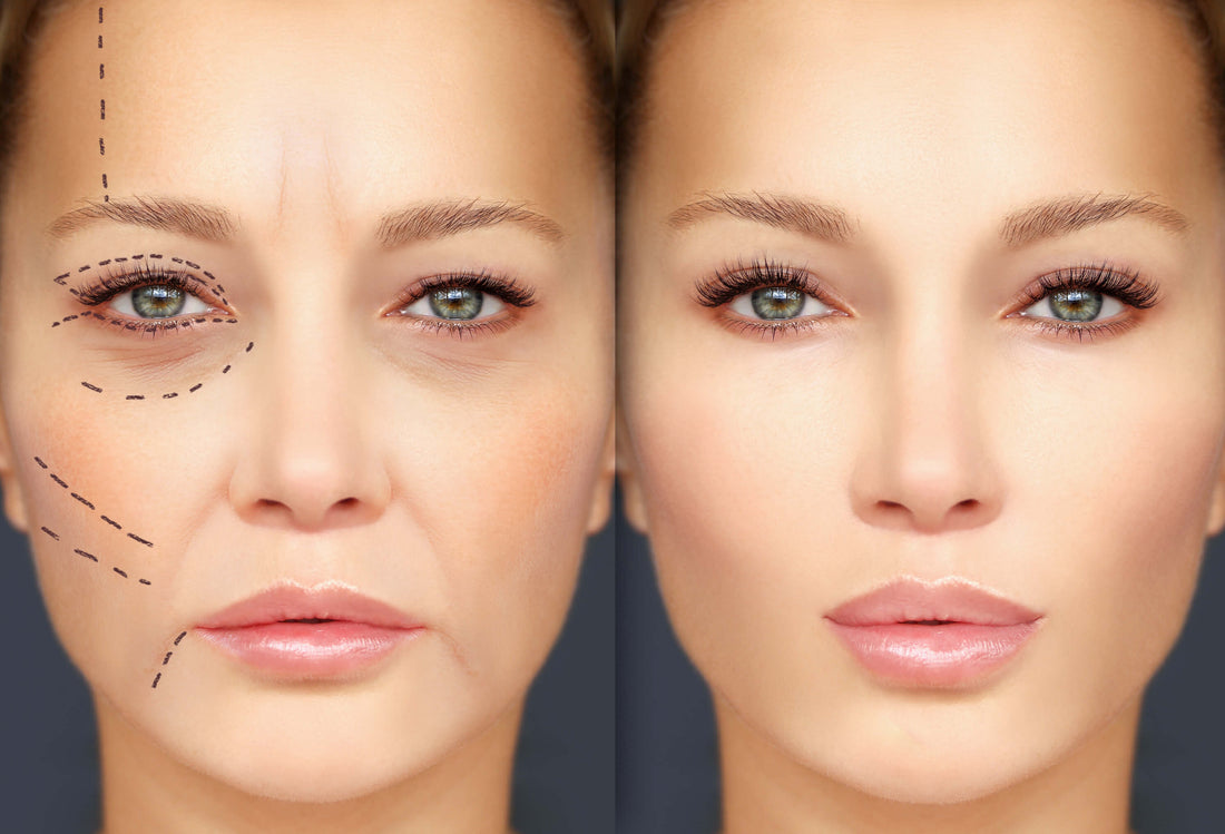 The Truth About Non-Surgical Facelifts: Do They Really Work?