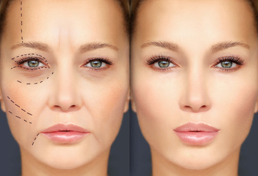 The Truth About Non-Surgical Facelifts: Do They Really Work?
