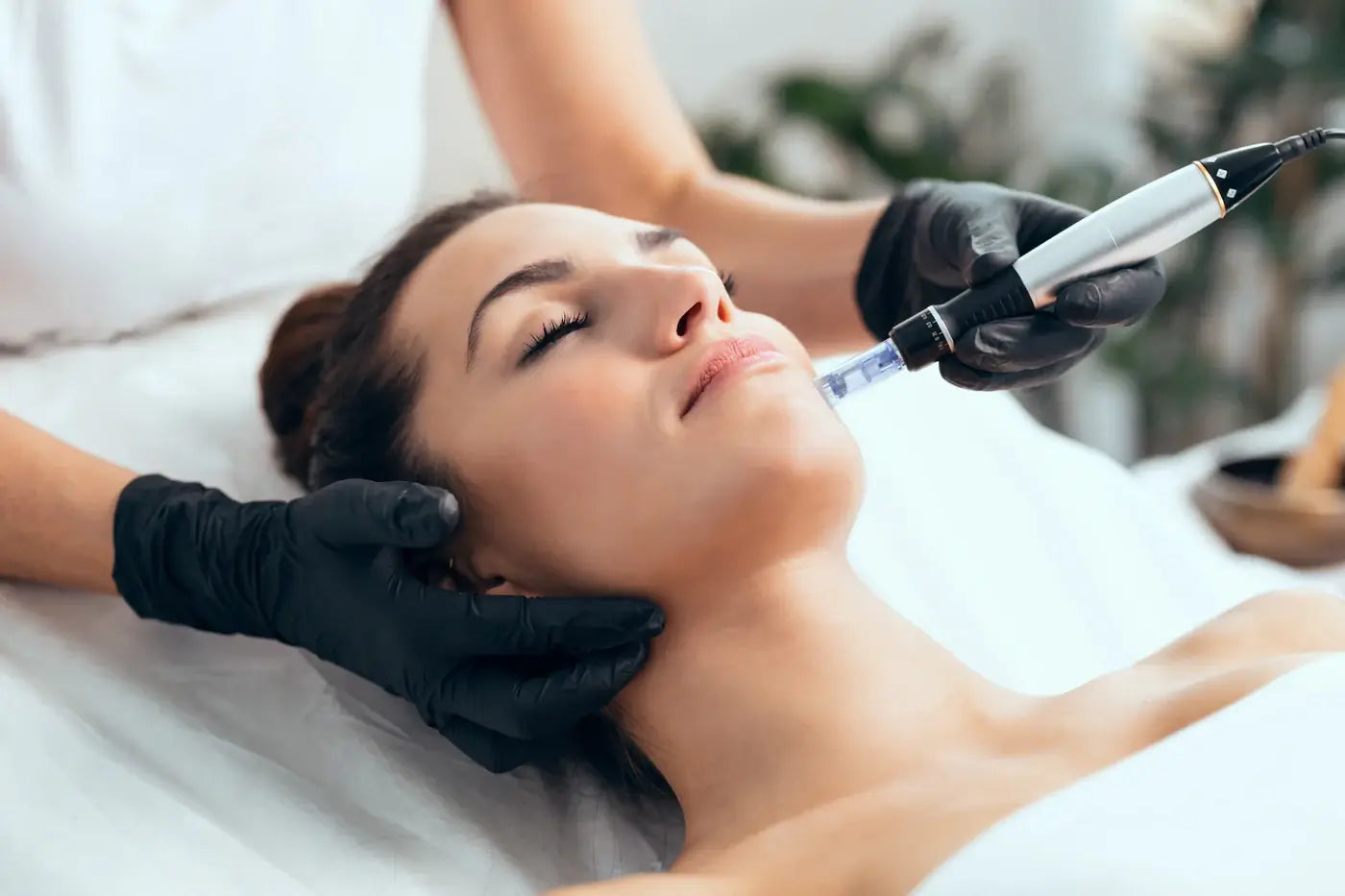 woman receiving microneedling treatment on her face