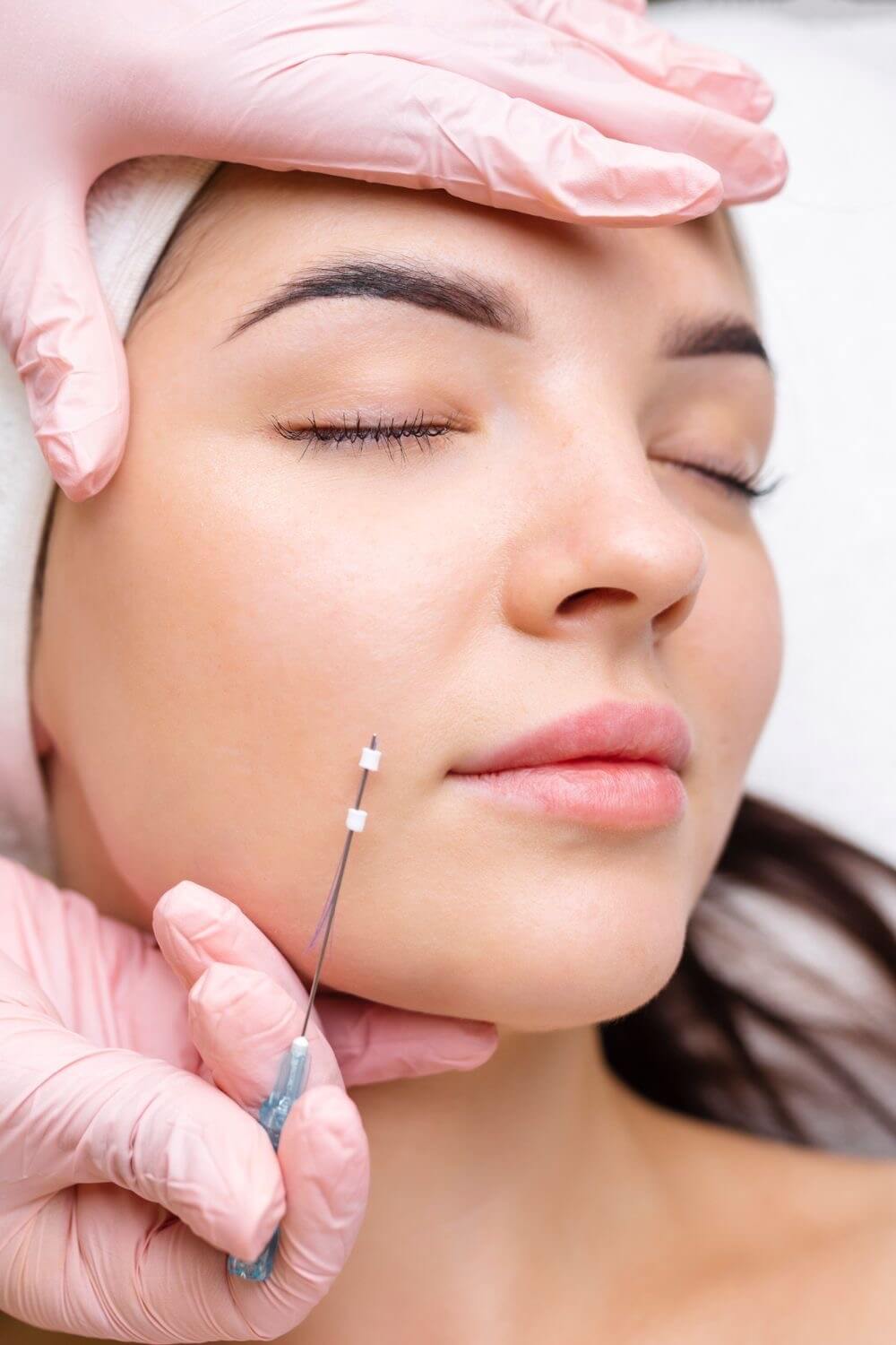 woman receiving Aptos thread lift treatment on her face